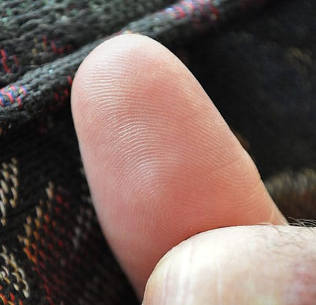photo of man's thumb pad totally healed with therapeutic essential oils from deep cut