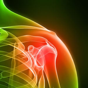 illustration of inflamed shoulder joint